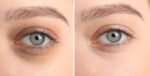 Puri Eyes 2% PN - Image 3